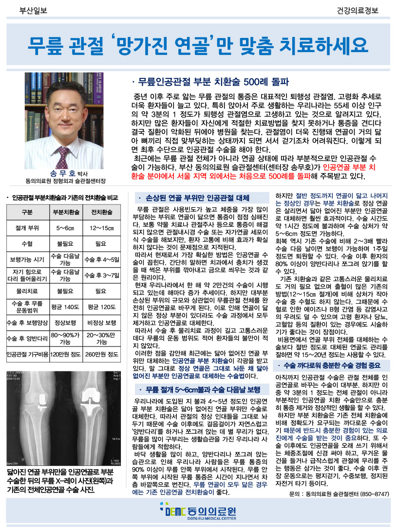 무릎 관절 ‘망가진 연골’만 맞춤 치료하세요