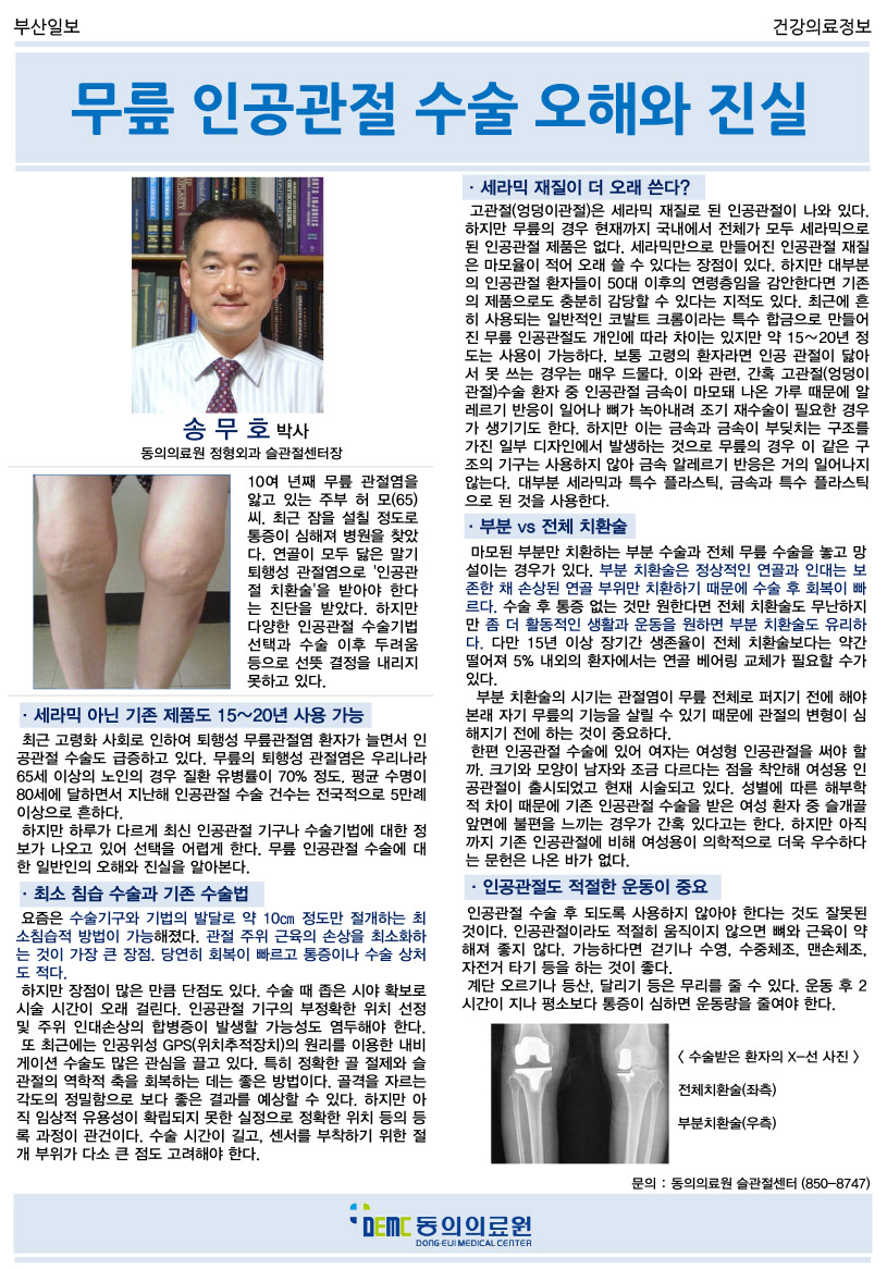 무릎 인공관절 수술 오해와 진실